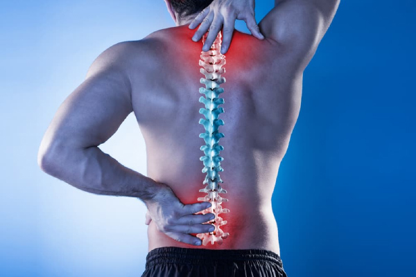 Trượt đốt sống: Nguyên nhân khiến lưng đau dai dẳng