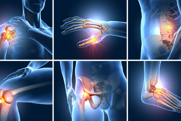 Đau nhức xương khớp toàn thân: Nguyên nhân và cách khắc phục hiệu quả