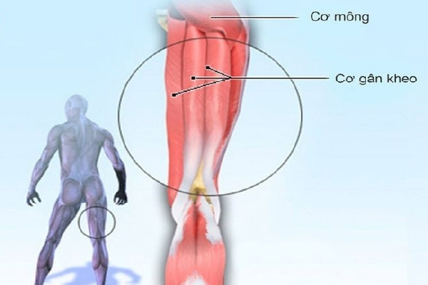Nguyên nhân nào dẫn đến chấn thương gân kheo?